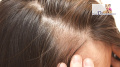 Szampon +balsam na porost włosów bio-rehab
